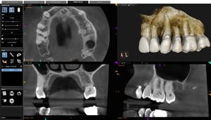 digital x-ray